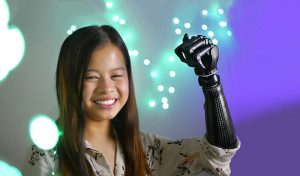 Sophia's Robotic Prosthetic arm